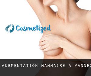 Augmentation mammaire à Vannes