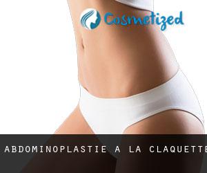 Abdominoplastie à La Claquette