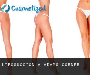 Liposuccion à Adams Corner Liposuccion à Adams Corner