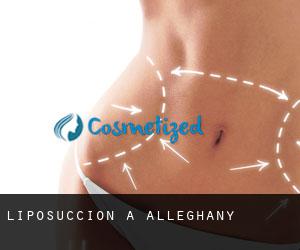 Liposuccion à Alleghany