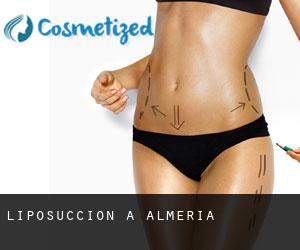 Liposuccion à Alméria