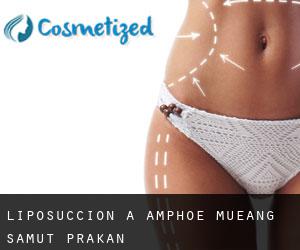 Liposuccion à Amphoe Mueang Samut Prakan Liposuccion à Amphoe Mueang Samut Prakan