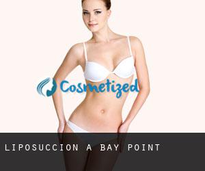 Liposuccion à Bay Point