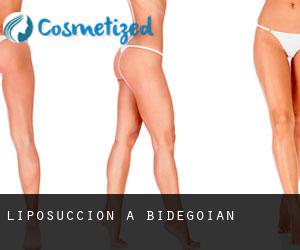 Liposuccion à Bidegoian Liposuccion à Bidegoian
