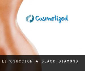 Liposuccion à Black Diamond