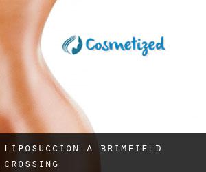 Liposuccion à Brimfield Crossing