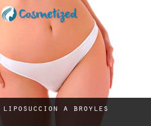 Liposuccion à Broyles