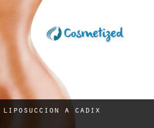 Liposuccion à Cadix Liposuccion à Cadix