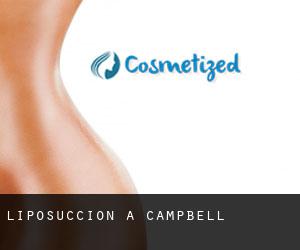 Liposuccion à Campbell