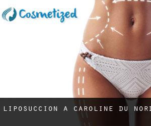 Liposuccion à Caroline du Nord Liposuccion à Caroline du Nord