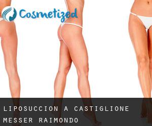 Liposuccion à Castiglione Messer Raimondo