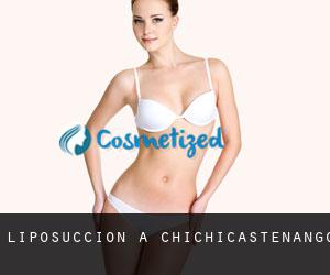 Liposuccion à Chichicastenango Liposuccion à Chichicastenango