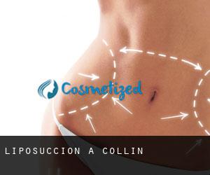 Liposuccion à Collin