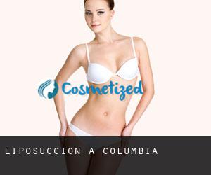 Liposuccion à Columbia Liposuccion à Columbia