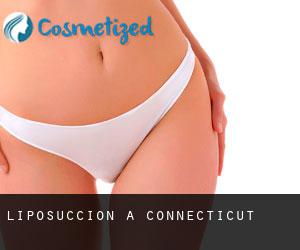 Liposuccion à Connecticut Liposuccion à Connecticut