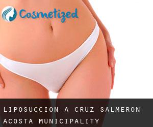 Liposuccion à Cruz Salmerón Acosta Municipality