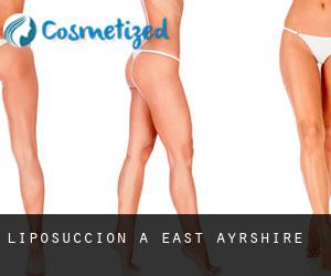 Liposuccion à East Ayrshire Liposuccion à East Ayrshire