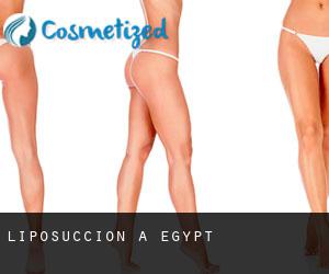 Liposuccion à Egypt