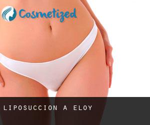 Liposuccion à Eloy Liposuccion à Eloy