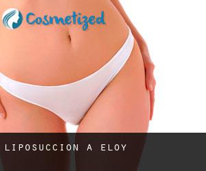 Liposuccion à Eloy