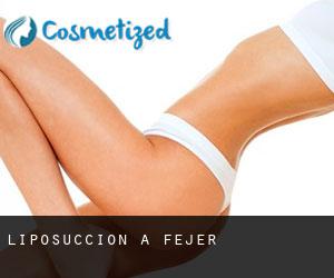 Liposuccion à Fejér Liposuccion à Fejér