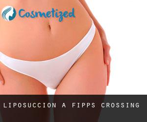 Liposuccion à Fipps Crossing