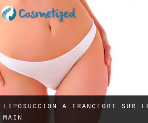 Liposuccion à Francfort-sur-le-Main Liposuccion à Francfort-sur-le-Main