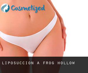 Liposuccion à Frog Hollow