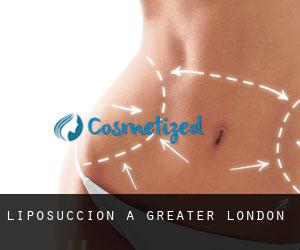 Liposuccion à Greater London Liposuccion à Greater London
