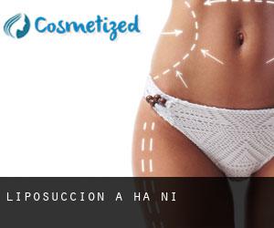 Liposuccion à Ha Nội Liposuccion à Ha Nội