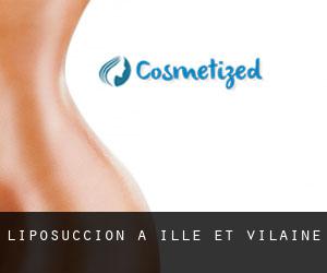 Liposuccion à Ille-et-Vilaine Liposuccion à Ille-et-Vilaine