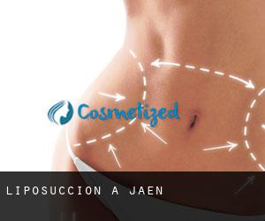 Liposuccion à Jaen