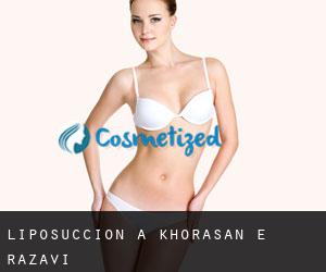 Liposuccion à Khorasan-e-razavi Liposuccion à Khorasan-e-razavi