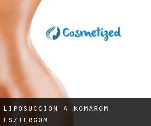 Liposuccion à Komárom-Esztergom Liposuccion à Komárom-Esztergom