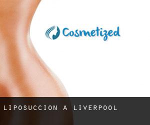 Liposuccion à Liverpool