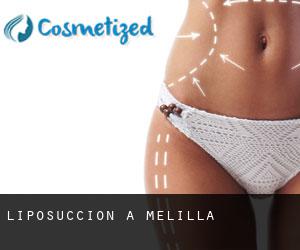 Liposuccion à Melilla Liposuccion à Melilla