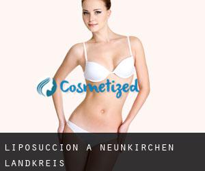 Liposuccion à Neunkirchen Landkreis Liposuccion à Neunkirchen Landkreis