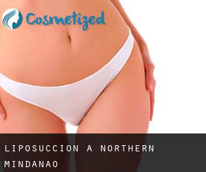 Liposuccion à Northern Mindanao Liposuccion à Northern Mindanao