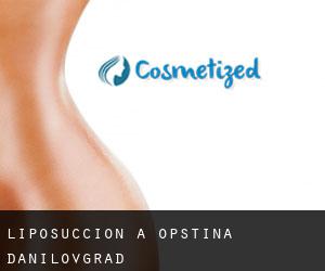 Liposuccion à Opština Danilovgrad Liposuccion à Opština Danilovgrad