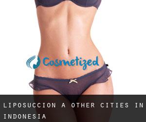 Liposuccion à Other Cities in Indonesia