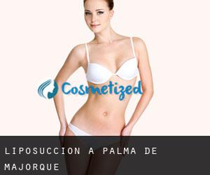Liposuccion à Palma de Majorque Liposuccion à Palma de Majorque