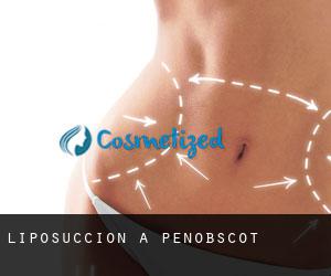 Liposuccion à Penobscot