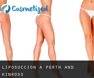 Liposuccion à Perth and Kinross Liposuccion à Perth and Kinross