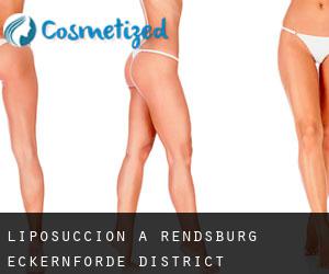 Liposuccion à Rendsburg-Eckernförde District Liposuccion à Rendsburg-Eckernförde District