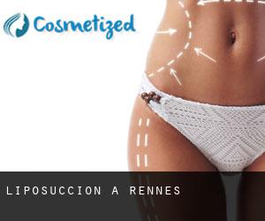 Liposuccion à Rennes Liposuccion à Rennes