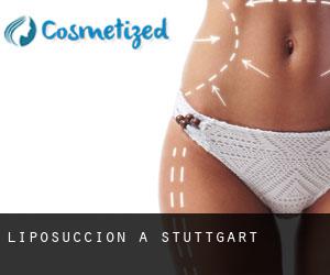 Liposuccion à Stuttgart Liposuccion à Stuttgart