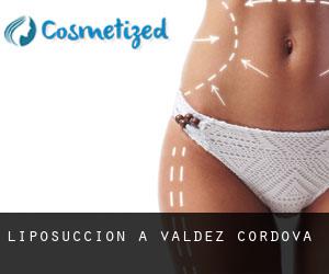 Liposuccion à Valdez-Cordova