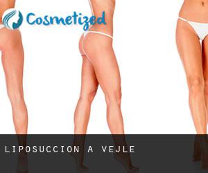 Liposuccion à Vejle Liposuccion à Vejle
