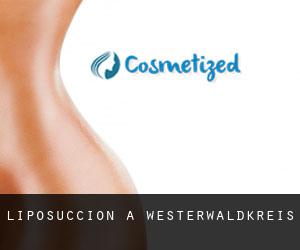 Liposuccion à Westerwaldkreis Liposuccion à Westerwaldkreis