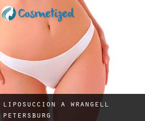 Liposuccion à Wrangell-Petersburg Liposuccion à Wrangell-Petersburg